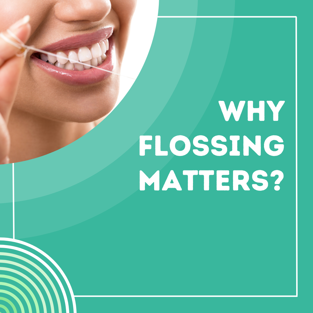 Why Flossing Matters